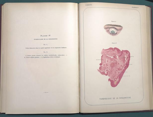 <strong>Histologie pathologique de l'oeil. Avec 20 planches dessinées d'après nature. </strong>